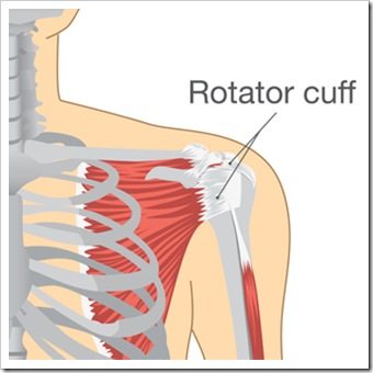 Shoulder Pain Sandy Springs GA Rotator Cuff Injury